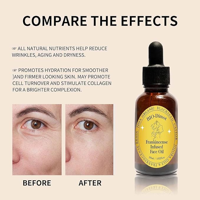 Frankincense Resin Oil For Face，Frankincense Resin Infused Organic Black Seed & Jojoba Oils,Natural skin Care moisturizing, Facial Anti-Aging Moisturizing skin Serum (1)