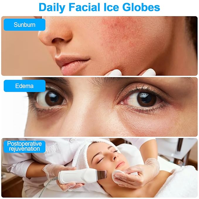 CGBE 360 Rotating Ice Globes For Face, Food-Grade Stainless Steel Facial Globes For Cryo Therapy, Smaller Ice Globes For Facials Reduce Wrinkles & Swelling - Black