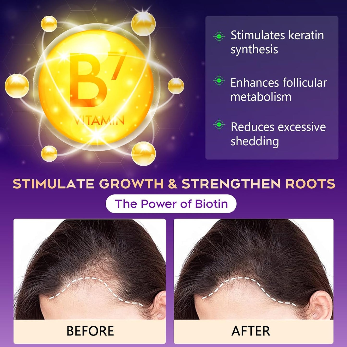 Biotin Hair Growth & Thickening Shampoo with Root Activator, Hair Loss Shampoo for Men And Women, Strengthen Roots, Control Oil & Thicken Thin Hair, Sulfate-Free, for All Hair Types, 10.1 Fl Oz