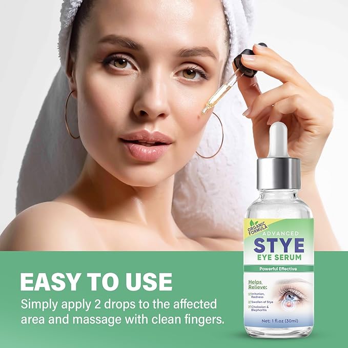 Stye Eye Treatment, Effective Stye Eye Drops Serum for Styes Chalazion and Blepharitis, Fast Chalazion Remover for Restore Healthier Ey-e Skin