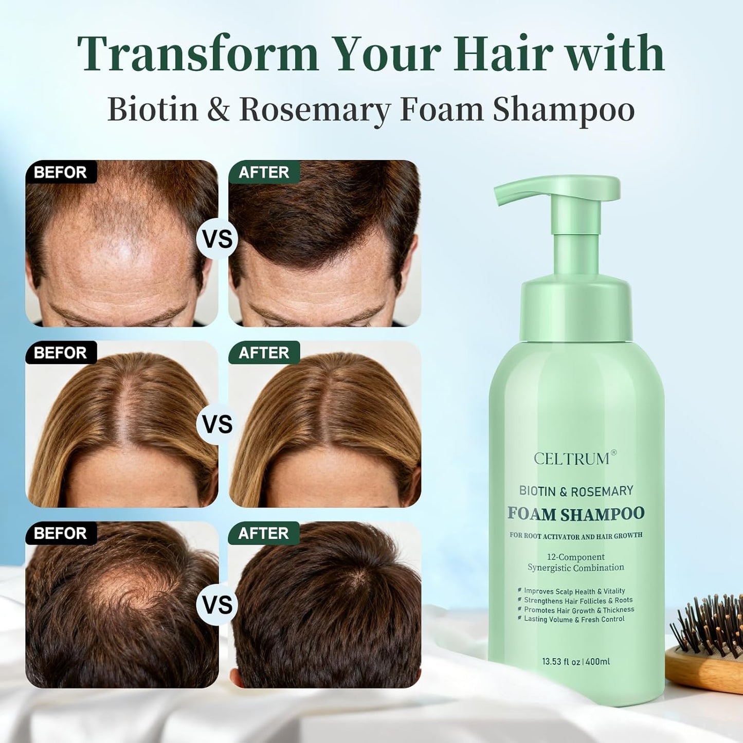 Foam Shampoo with Biotin & Rosemary for Hair Growth, Root Activator for Men and Women, 12-Component Synergistic Blend for Visibly Thicker Hair - 13.53 fl oz (Pack of 2)