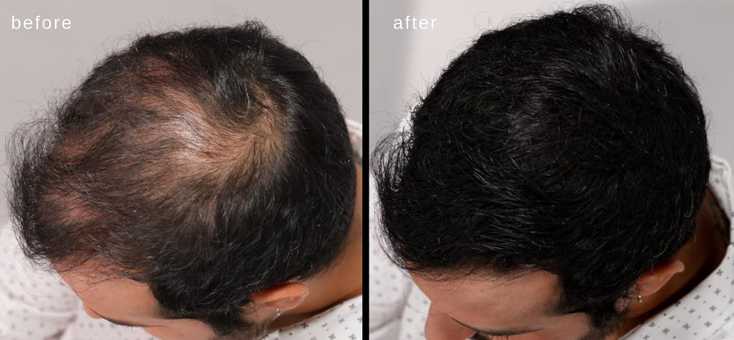 LUXE Hair Building Fibers - Thickening Fibers - CONFIDENCE IN A JAR – 2 + Months Supply – Hypoallergenic, Dermatologist Tested – Multiple Colors Available (Black)