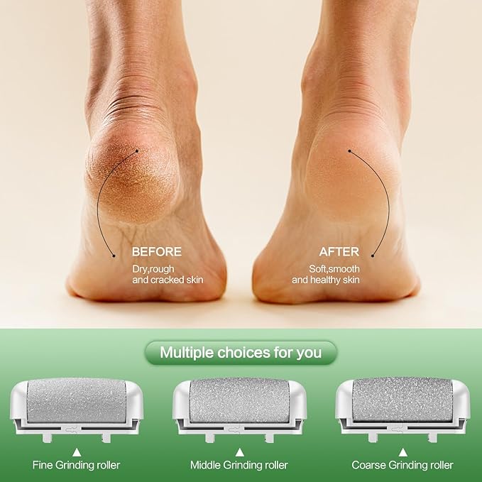 Electric Foot Callus Remover, LED Light & Display Electric Foot File, Rechargeable Waterproof Electric Foot Filer, 3 Replacement Rollers & USB-C Charging Foot Sanders for Feet White