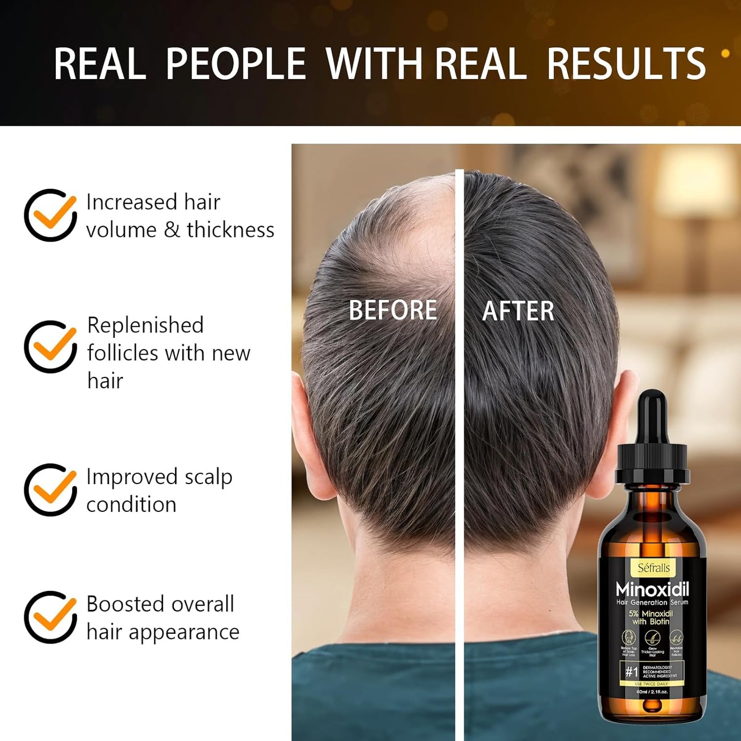 2-Pack 5% Minoxidil Hair Growth Serum for Men and Women, Hair Regrowth Treatment for Stronger, Thicker, and Longer Hair, Facial Hair Grooming and Thickening Solution