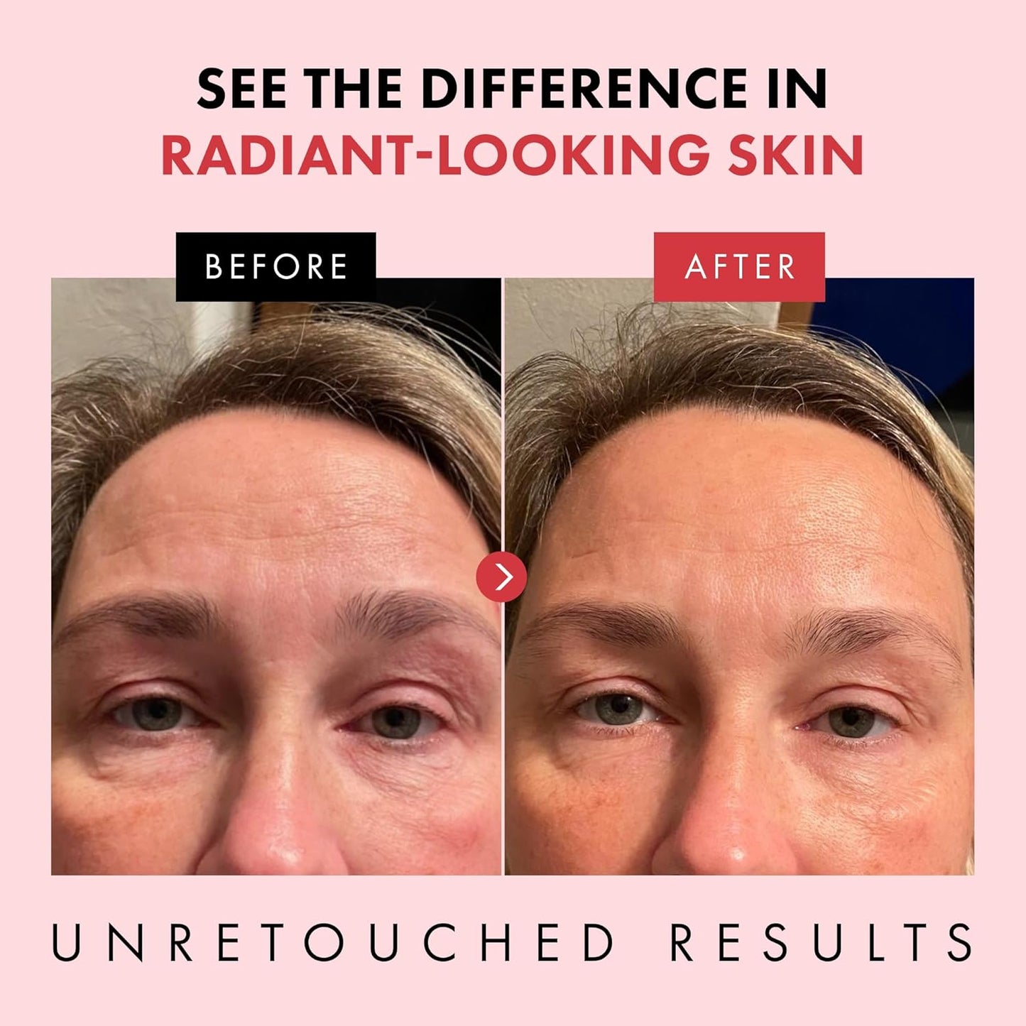 Eclat Skincare Retinol Night Cream – 2.5% Retinol & Hyaluronic Acid Face Moisturizer for Wrinkles, Fine Lines & Hydration – Firming Anti Aging Cream for Smooth, Radiant Skin 1.7 fl oz