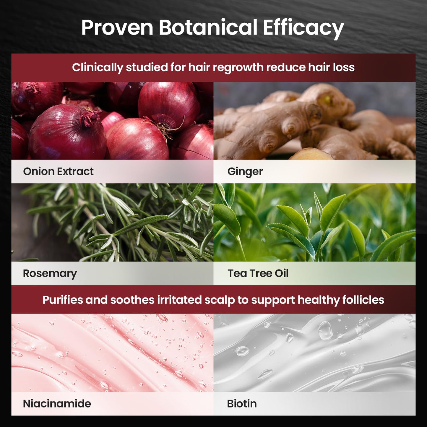 Onion & Biotin Hair Growth Shampoo: Infused With Natural Rosemary Tea Tree Oil Anti Hair Loss Shampoo - Scalp Smooths Thickening Formula Support Hair Regrowth For Women Men (12.5 Fl Oz)