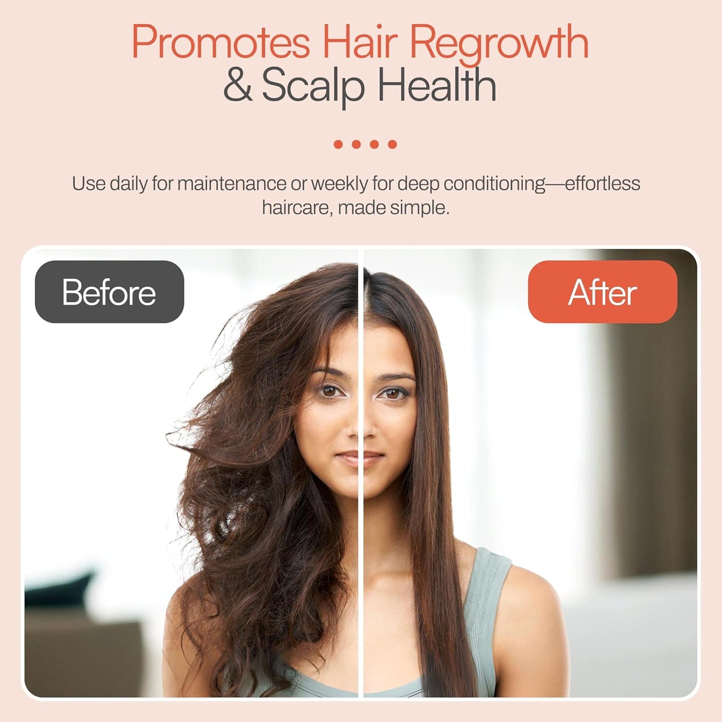 Foltene Sulfate Free Conditioner for Women – Anti-Aging and Moisturizing Conditioner for Dry Hair – Enriched with Vitamin E, Panthenol & Macadamia Oil for Smooth, Shiny & Healthy Strands