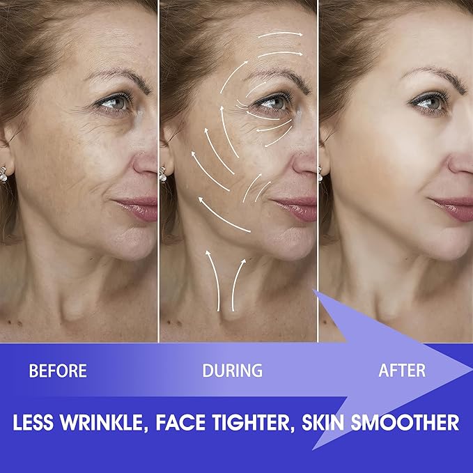 Anti Wrinkle Patches 160 PCS Face Lift Tape, Anti aging Face Tape for Neck, Smile Line, Eye, Forehead, Sensitive Sleep Patches for Women Face Tightening