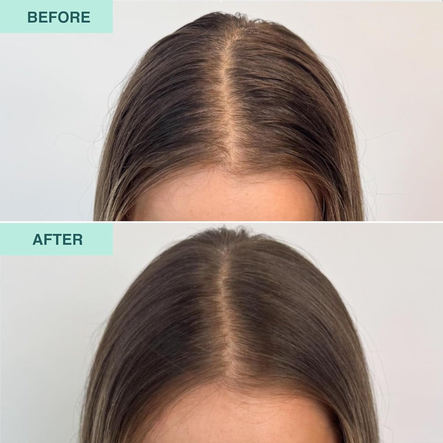 FUNCTION OF BEAUTY Clarifying & Detox Shampoo (11 oz) – For for All Hair Types – Removes Build Up & Oil with Rosemary, Sage & Aloe – Sulfate-Free, Vegan Hair Care