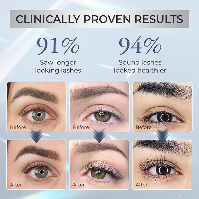 Abera Misan Eyelash Growth Serum (Upgrade Version) - Natural Lash Booster and Lash Enhancer, Regenerating and Nourishing Lashes Longer and Thicker (2. Set of 2 with Gift)