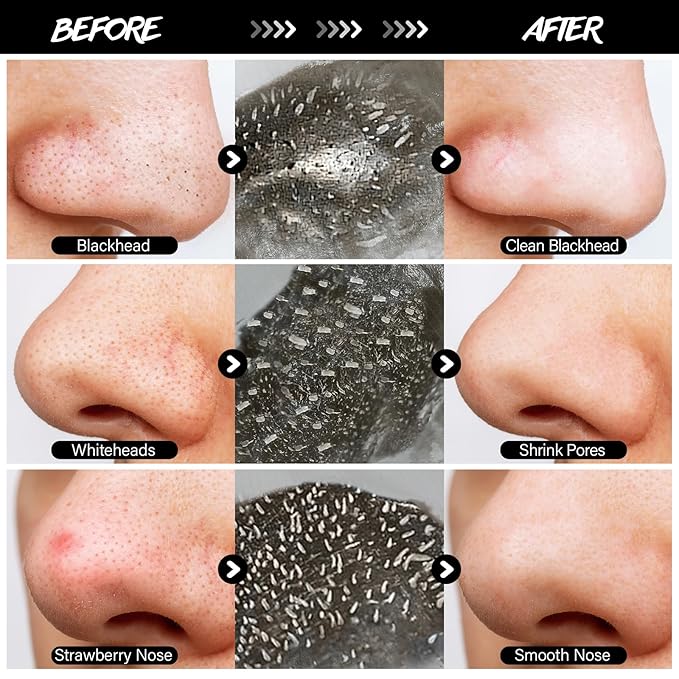 Blackhead Pore Strip 2pcs Aloe Vera Blackhead Remover Strip Bamboo Charcoal Nose Pore Strips Deep Cleaning Whitehead Strawberry Noses Blackhead Remover Face Mask Shrink Pores With 120pcs Paper
