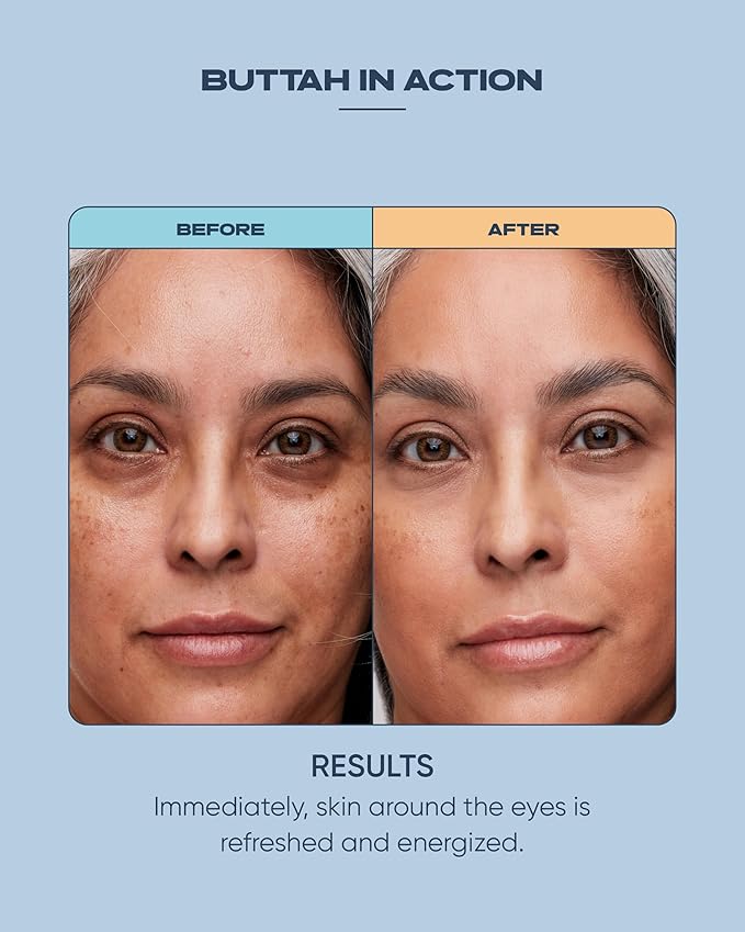 Buttah Skin Awakening Eye Cream for Dark Circles and Puffiness - Anti Aging Eye Care Cream - Eye Cream For Wrinkles - Nourishing and Hydrating Under Eye Treatment with Natural Ingredients