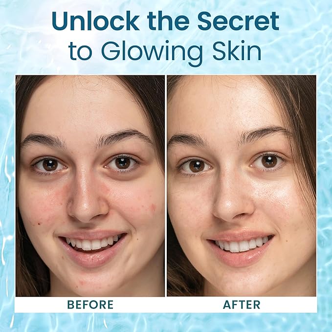 Honeyskin - Hyaluronic Acid Serum for Face with Vitamin E Oil for Skin - Anti-Aging and Hydrating Face, Hydration Moisturizer with B5 - Non-Greasy, Paraben Free, Wrinkle Reducing Serum - (2oz)