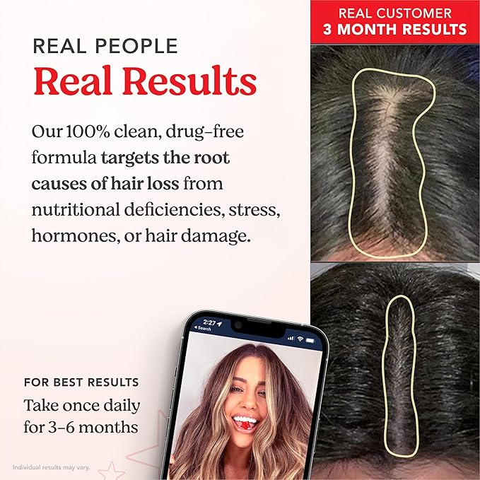 HAIRtamin Vegan Gummy Stars Hair Vitamins | Non-GMO | Natural Biotin Hair Vitamin Gummies to Maintain Healthy Hair Skin & Nails | Multivitamin Supplement to Help Maintain Healthy Looking Hair (3-Pack)