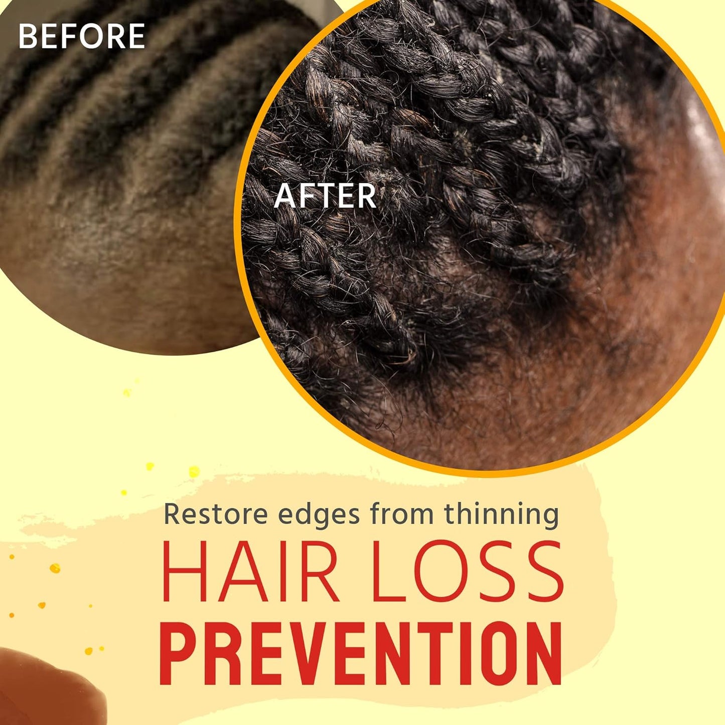 Glammed Naturally - Braid Oil for Itchy Scalp and Dry Scalp, Braid Care Oil for Dandruff, Lice and Thinning Edges, 2 oz