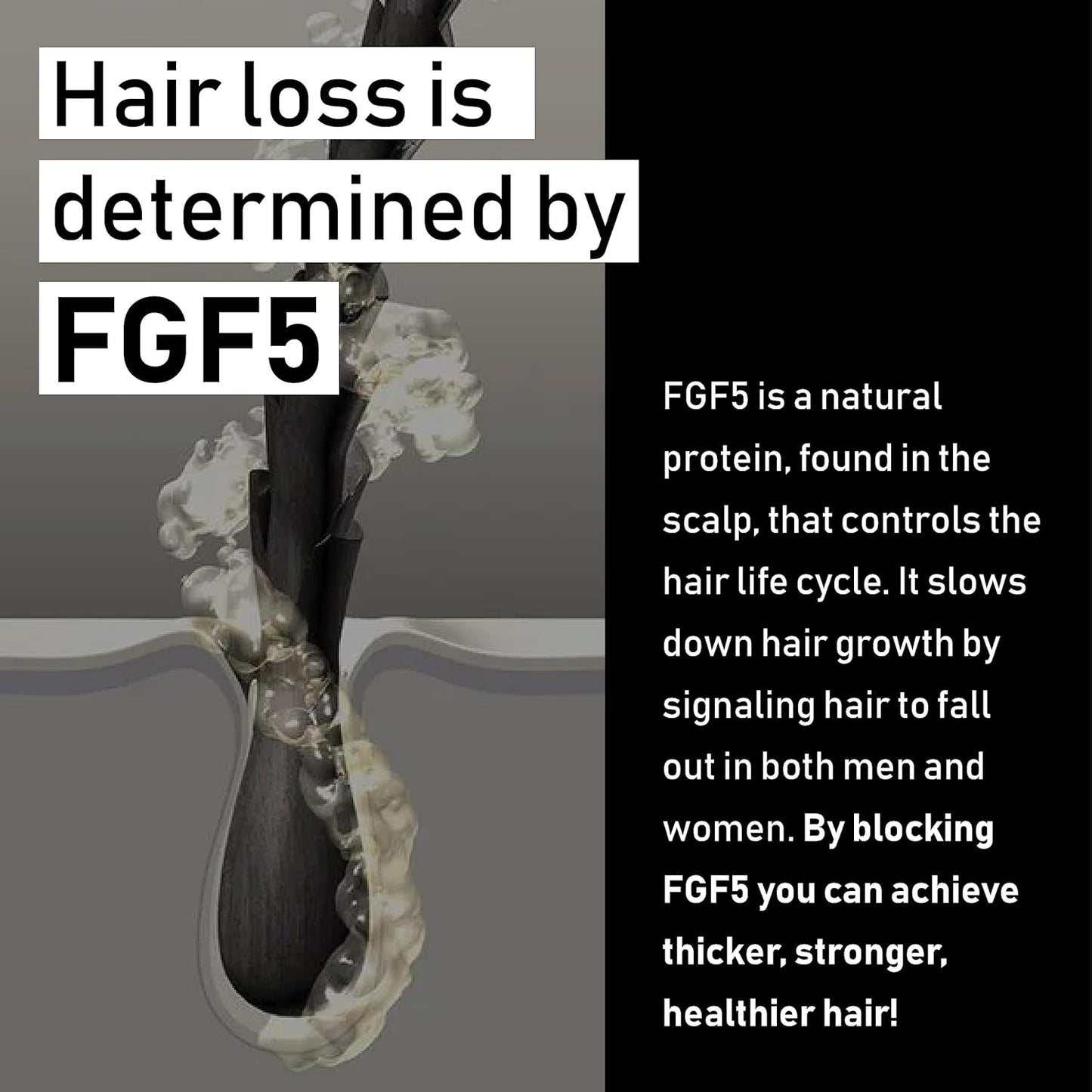 EVOLIS PREVENT Shampoo & Conditioner - Anti Hair Loss Treatment for Men and Women - Preventative Hair Loss Shampoo & Thickening Conditioner