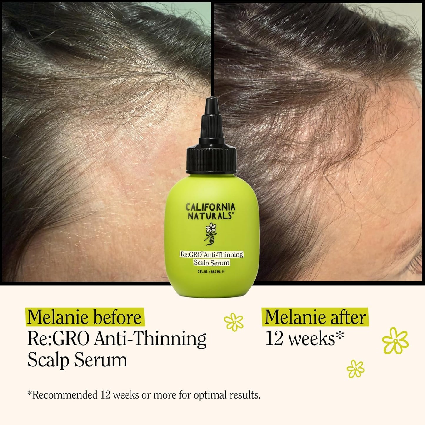 California Naturals Women's Re: Gro Anti-Thinning Scalp Serum, 5% Capixyl with Biotin, Caffeine & Castor and Rosemary Oil, Non-Sticky Cooling Formula, Vegan & Cruelty Free, 3oz