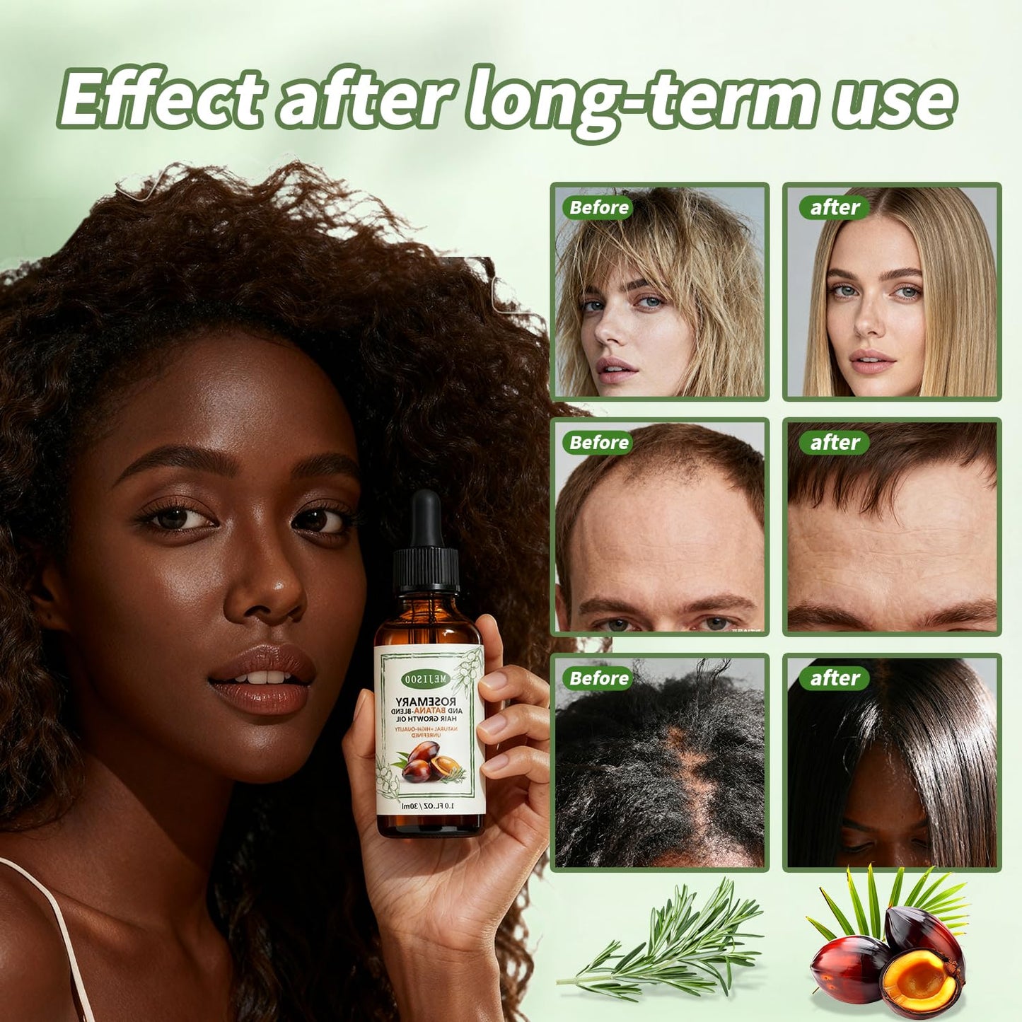 Organic Batana Rosemary Oil for Hair Growth & Anti-Hair Loss, Natural DHT Blocker Scalp Treatment for Thinning Hair, Nourishing Dry Scalp & Strengthening Follicles Cold-Pressed, Non-Greasy, 1 fl oz