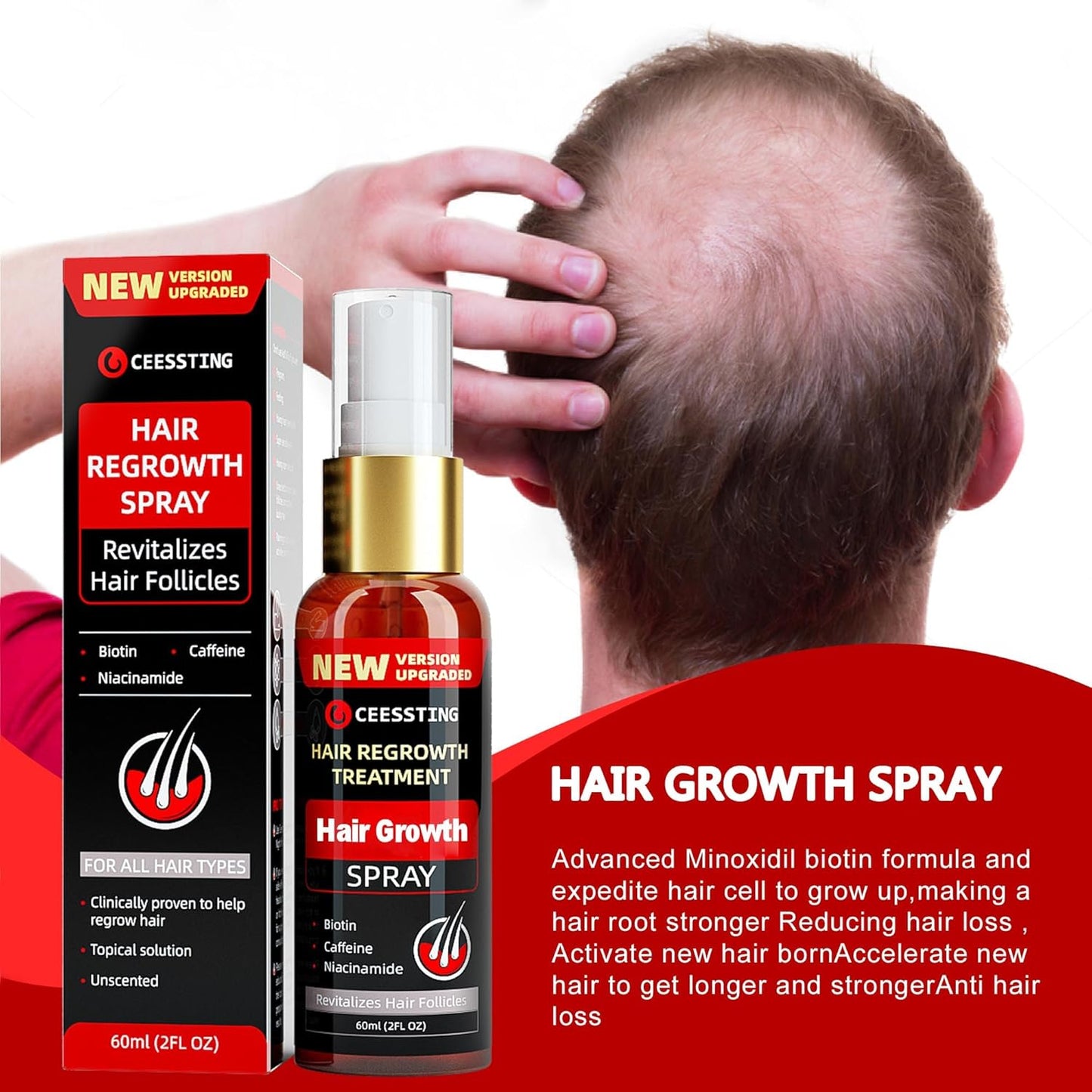 Hair Growth Spray by Ceessting- Biotin, Caffeine and Niacinamide - Anti-Hair Loss for Thinning Hair -Hair Regrowth Treatment for Men and Women- 2 Ounces