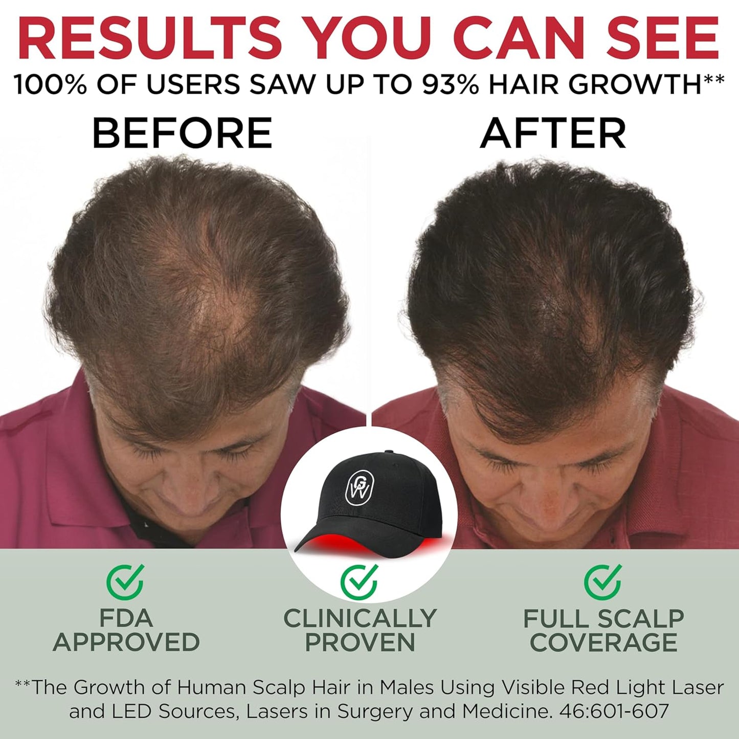 Red Light Therapy Hair Growth Cap – FDA Cleared Laser Treatment for Hair Regrowth and Reduced Shedding – LED & Laser Red Light Therapy Clinically Proven in Double-Blind Studies -Black