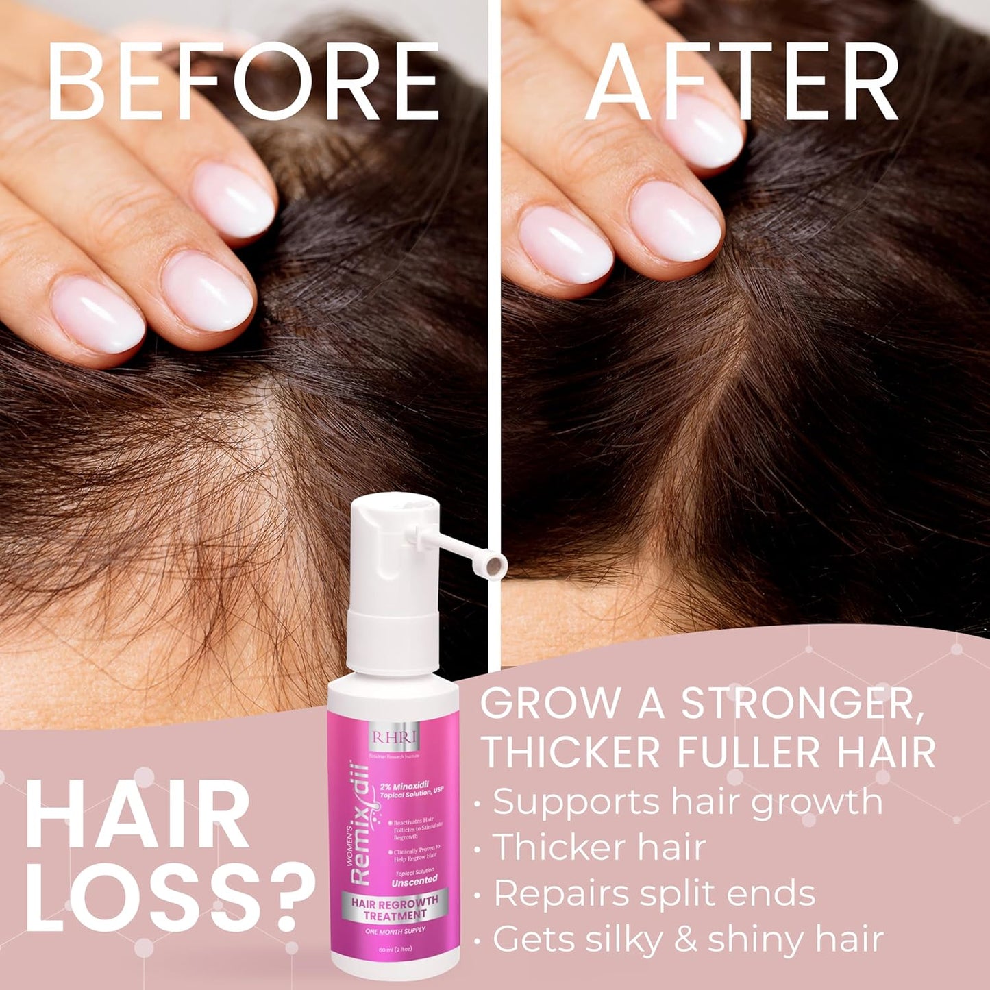 2% Minoxidil for Women Hair Regrowth Spray– Minoxidil Thicker & Fuller Topical Solution for Hair Loss Treatment, Follicle Reactivation, Clinically Proven Formula - 60 ml