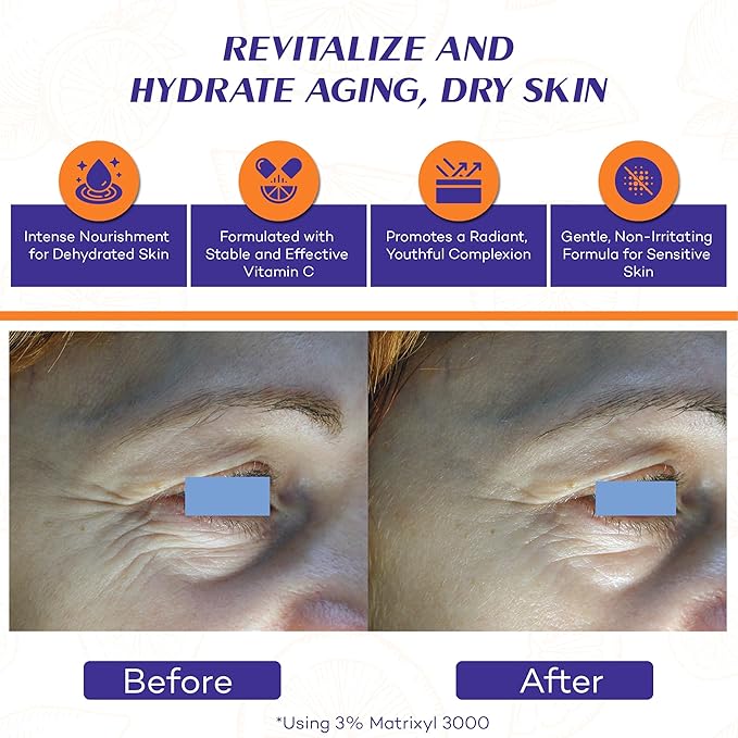 Vitamin C Brightening Facial Oil for Aging and Dry Skin with Matrixyl 3000 & Hyaluronic Acid