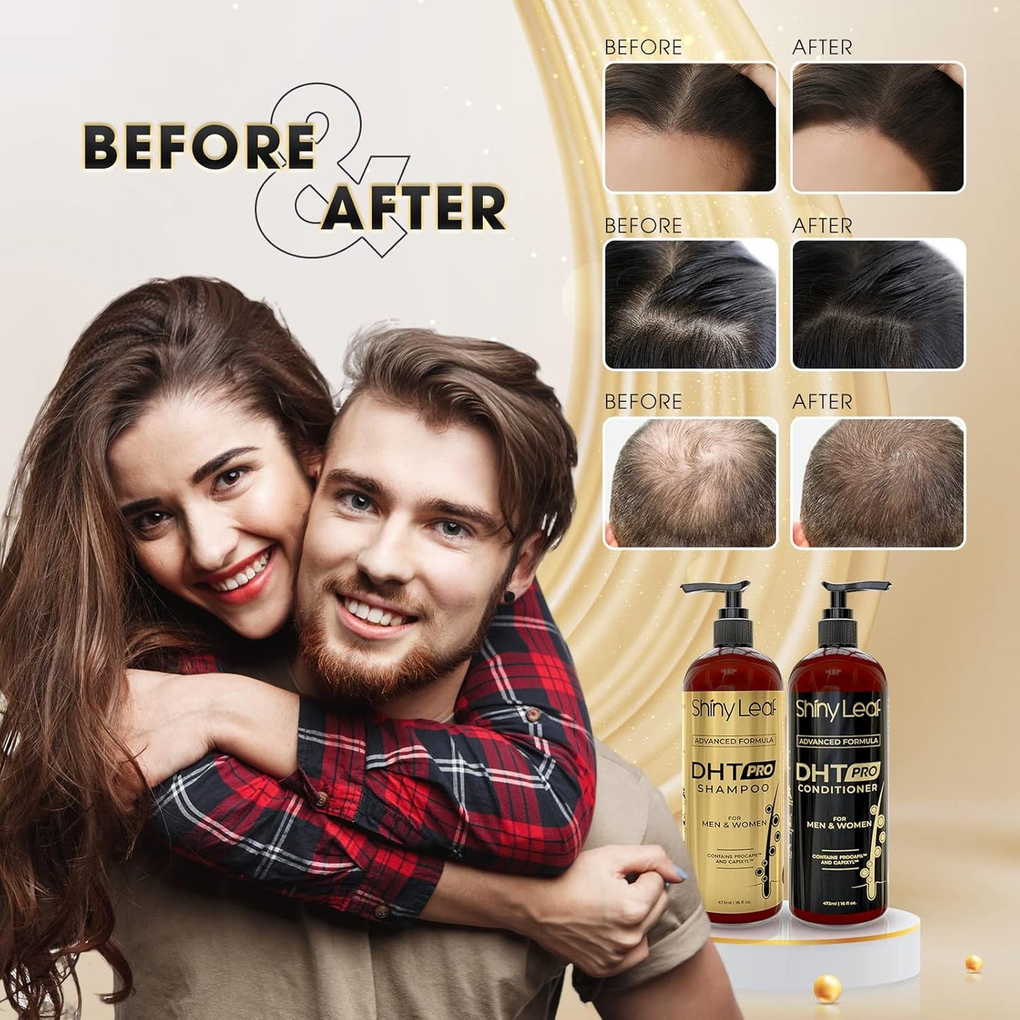 DHT Pro Shampoo Advanced Formula - Made In USA With Procapil And Capixyl, DHT Blockers And Natural Extracts, Anti-Thinning Shampoo for Men and Women, Stimulates Follicles For Thicker Fuller Hair