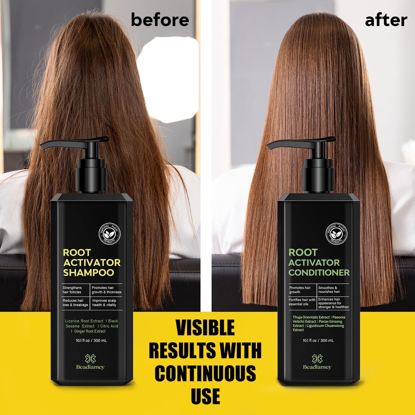 Root Activator Shampoo and Conditioner for Men: Hair Growth Set for Hair Loss and Thinning Hair