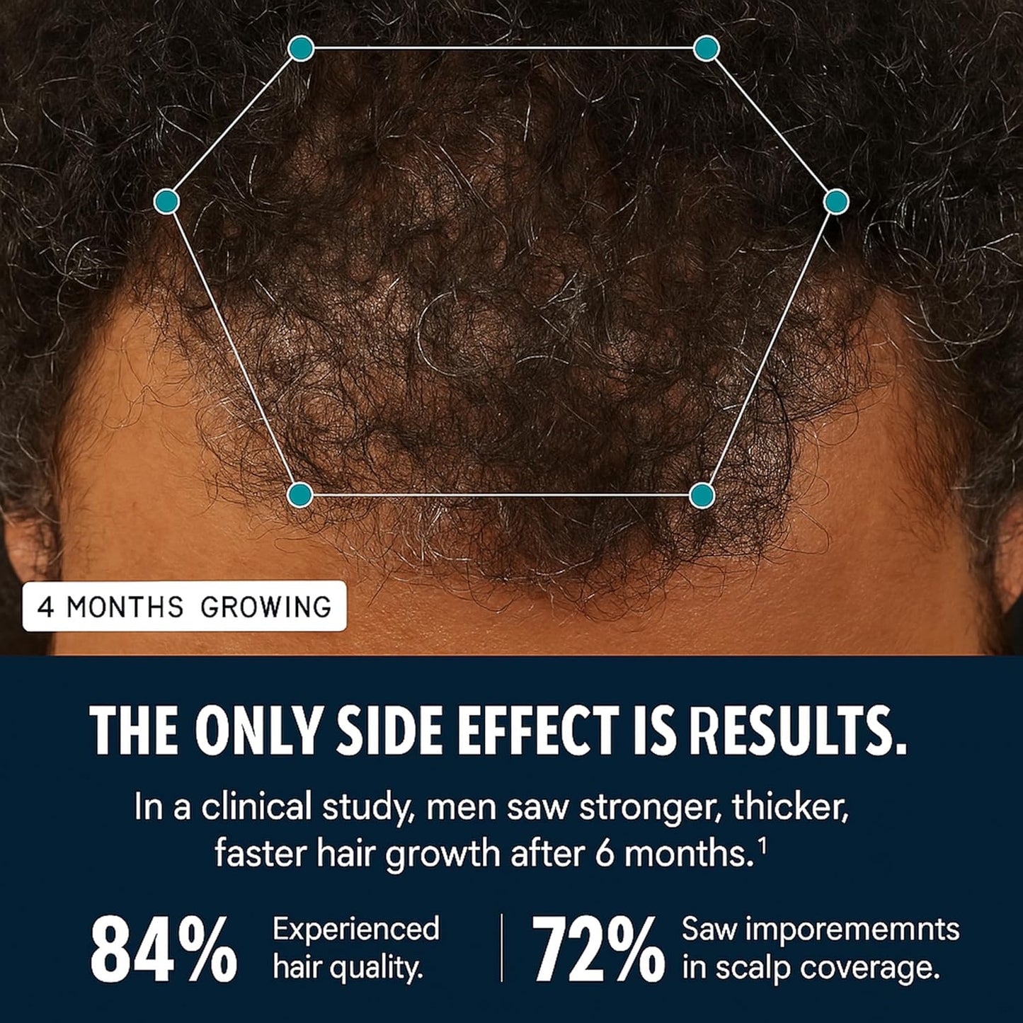 Men's Hair Growth Supplement – Clinically Tested Hair Growth Vitamins for Men, Thicker Hair & Scalp Coverage, Hair Regrowth Support for Men – Stronger, Fuller Hair – 1 Month Supply