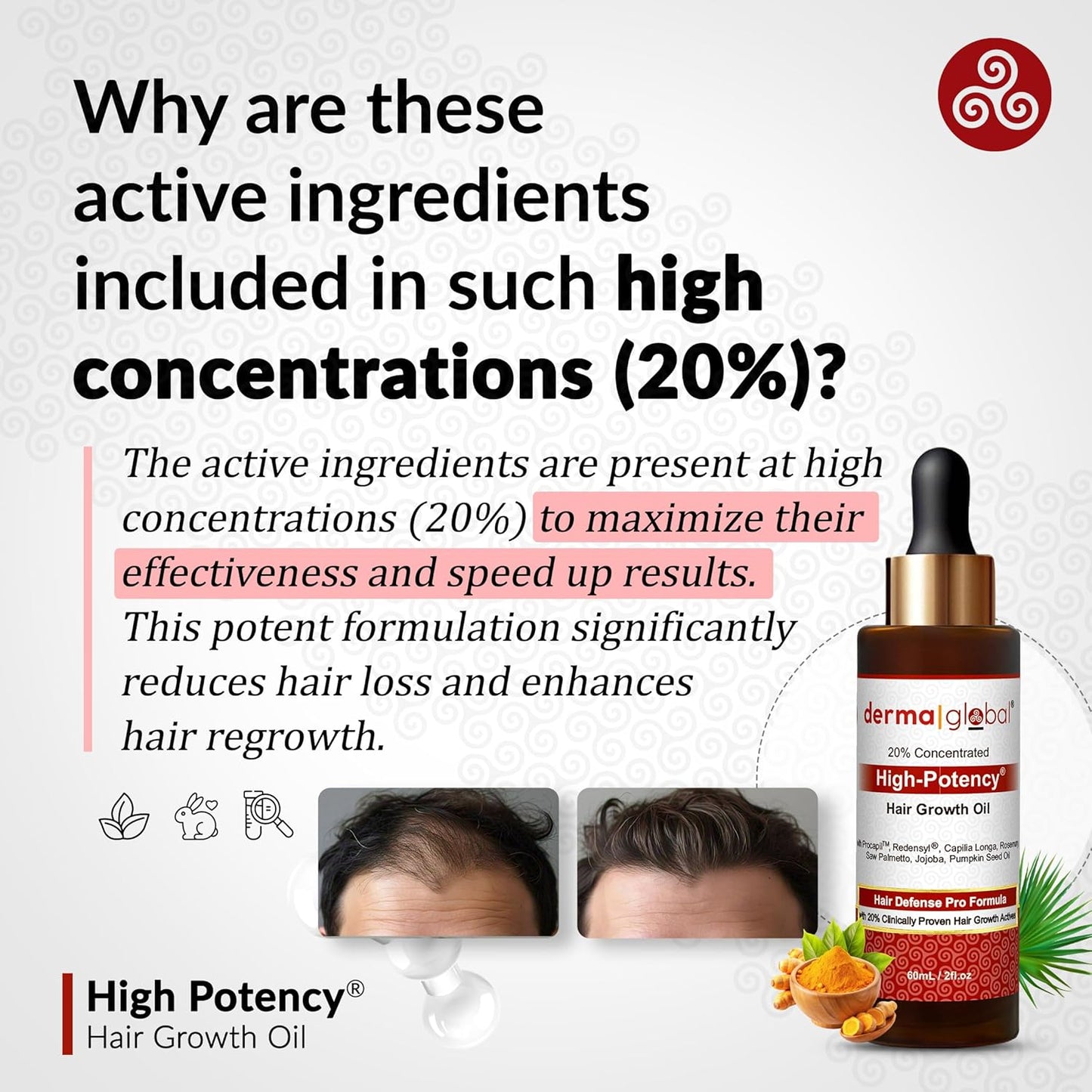 High Potency® Hair Growth Oil – Hair Defence Pro Formula | 20% Clinically Proven Actives including Procapil, Redensyl, Capilia Longa, Rosemary, Saw Palmetto, Jojoba, Pumpkin Seed Oil