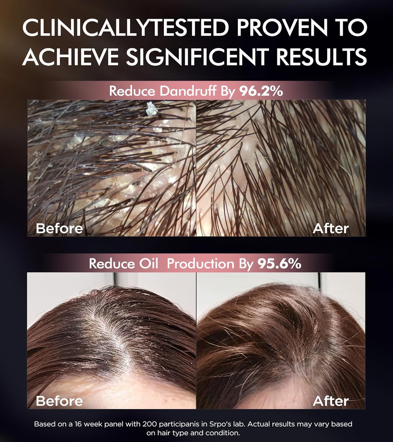 Dual Essence Hair Growth Shampoo and Conditioner Set with Biotin&Tripeptide, 3X Moisturizing Biotin Shampoo for Softer Shiner Hair, Anti-Loss Dandruff Routine Rosemary Shampoo for Men Women, 2x16.9oz