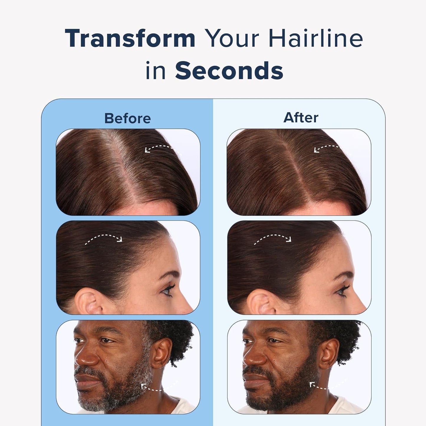 TRUHAIR Jumbo Color & Conceal Waterproof Root Touch Up Hair Color for Gray Hair Coverage - Instant Root Cover Up Hair Powder for Women & Men - Bald Spot Concealing, Hairline Filling (Light Brown)