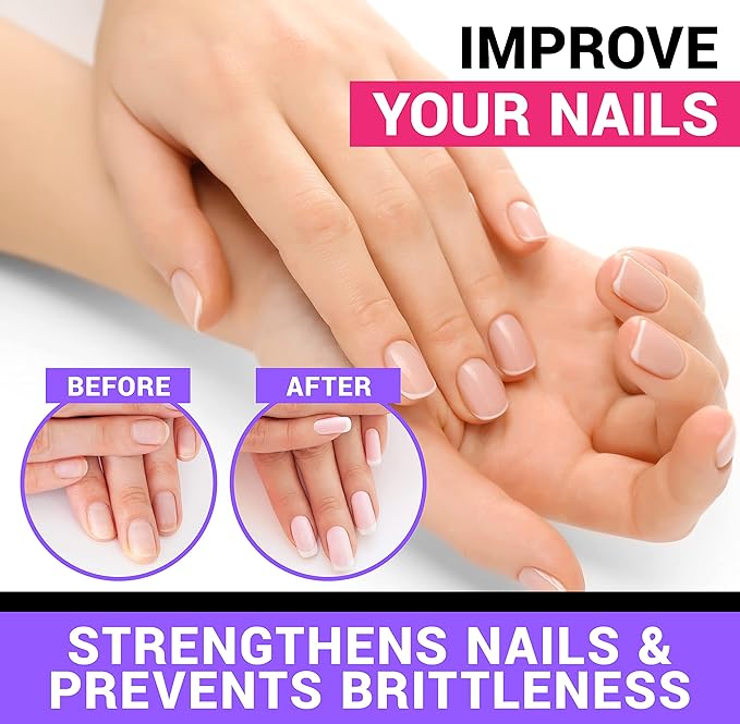 Potent Biotin (Vitamin B7) 10,000 mcg with Vitamins D & E Supplement | 180 Count | Hair, Skin And Nails | For Thicker & Stronger Hair Growth | Healthy, Youthful Skin & Strong Nails | Energy Support