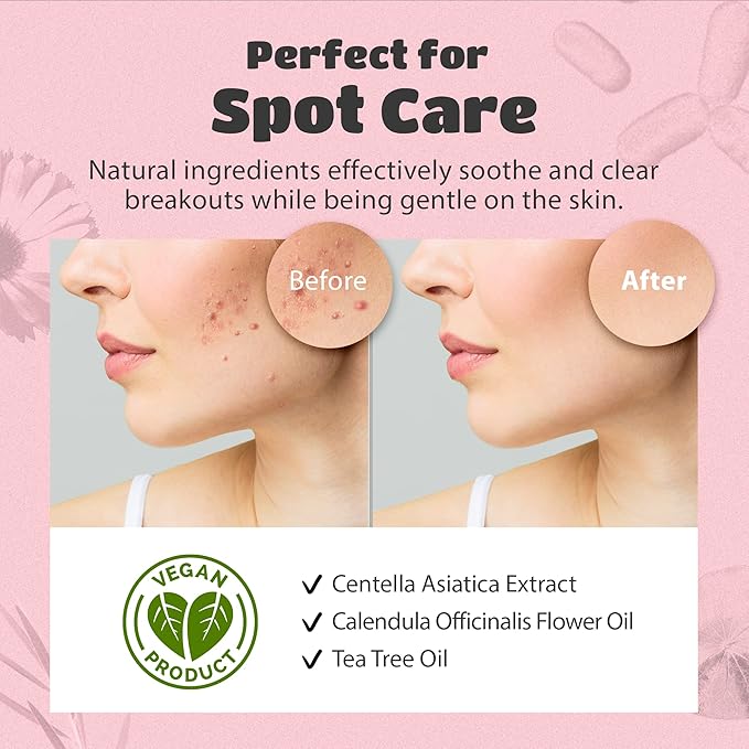 lattcare Dalgona Skin Shield Patches | Dalgona Candy Shaped Hydrocolloid Acne Patches | Make Your Face Acne Look Cute | No Dyes, Vegan, Cruelty Free | (30 Count / 3 Shape Sizes)