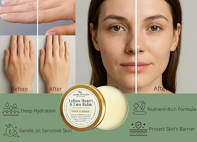 Organic Tallow Honey Emu Oil Balm Grass Fed Handmade Moisturizing Tallow For Face and Body for Eczema Rosacea Rashes All Ages All Skin Types Healing Hand Balm | Made in USA