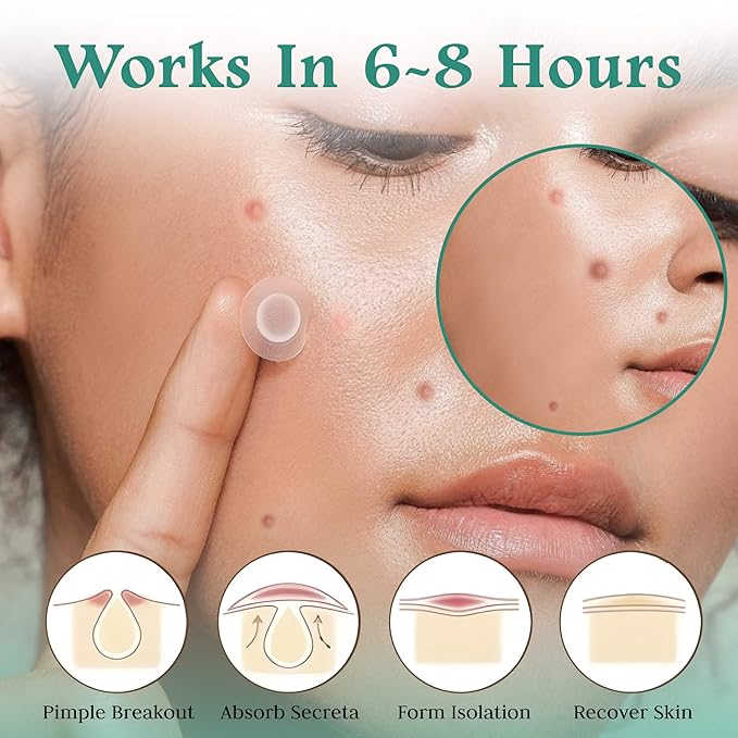 Advance Invisible Pimple Patches For Face (96 Pack) - Hydrocolloid Patch with Tea Tree Oil - Vegan Friendly Hydrocolloid Acne Patches For Face - 3 Size Pimple Patch Stickers (7,10,12mm)
