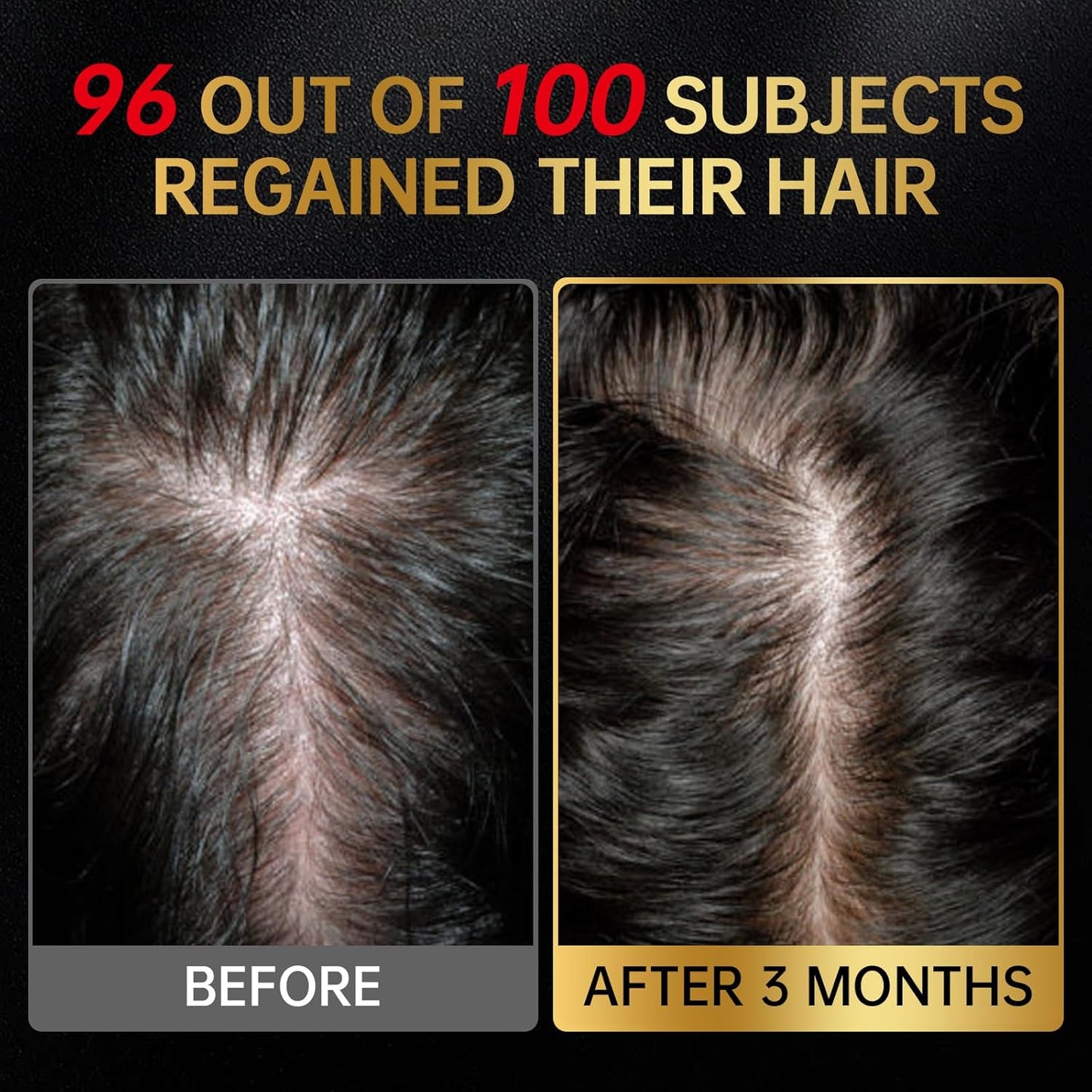 Minoxidil for Men & Women, With Biotin, Batana Oil, Rosemary Essential Oil, Effective Hair Loss Solution, Hair Loss Treatment for Hair Regrowth, Non-Greasy 5% Minoxidil - 60ml