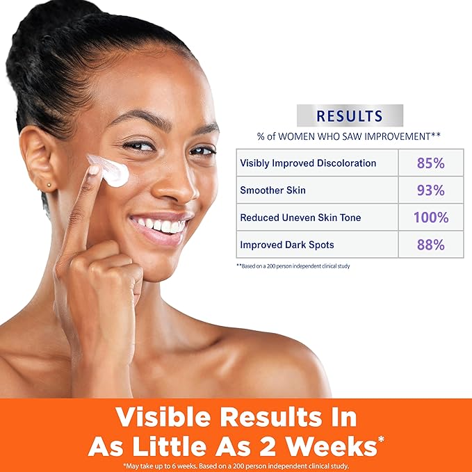 Palmer's Skin Success Anti-Dark Spot Nighttime Fade Cream with Retinol & Niacinamide, Dark Spot Corrector for Face, Night Moisturizer Helps Reduce Dark Spots, Fine Lines & Wrinkles, 2.7 Ounce