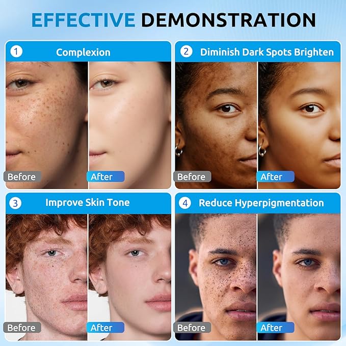 Dark Spot Remover for Face Cream, Dark Spot Corrector, Rapid Tone Repair Retinol, Skin Brown Spot Remover, Skin Care Face Cream, Sun Spot Remover, Age Spot Corrector for Women Men (2 Fl Oz)