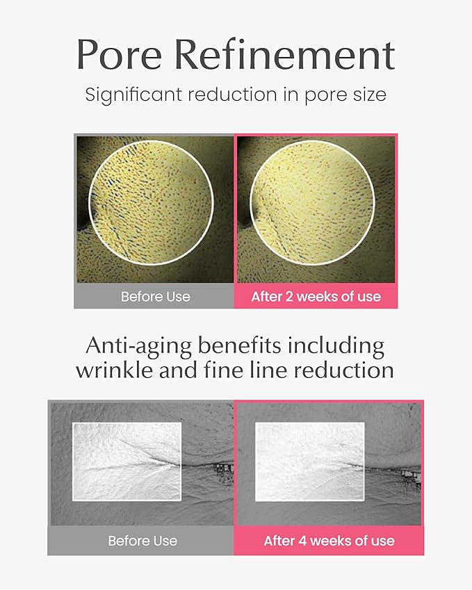 Derma Pore 4D Collagen Serum – Korean Skincare, 50ml/1.69 fl.oz | Hydrating Peptide Serum for Pore Minimizing & Radiant Skin | Korean Glass Skin Essence