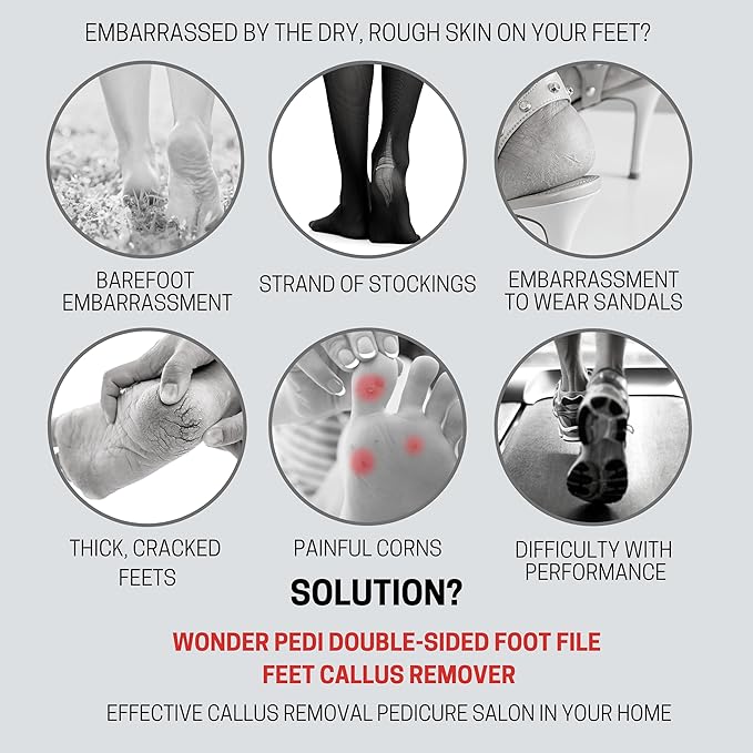 Made in Germany Double Sided Metal Foot File - Stainless Steel Feet Callus Remover - Feet Scrubber Dead Skin - Heel Scraper Cracked Heels Repair Professional Foot Rasp.