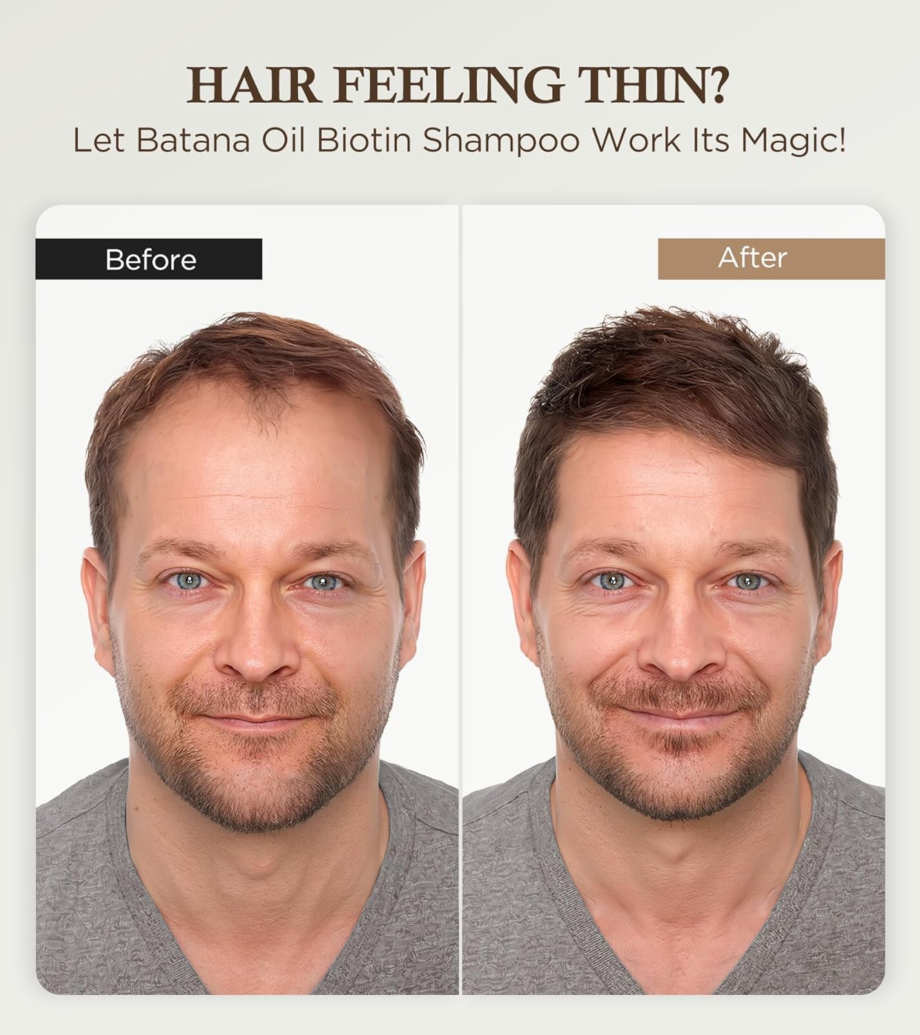 99% Pure Biotin Shampoo for 3X Thicker, Fuller Hair Growth, 80% Less Hair Loss w/Thuja Extract, Batana & Noni Fruit Oil Hair Care for Deep Nourishing,Rosemary Dandruff Treatment for Men Women,11.83oz