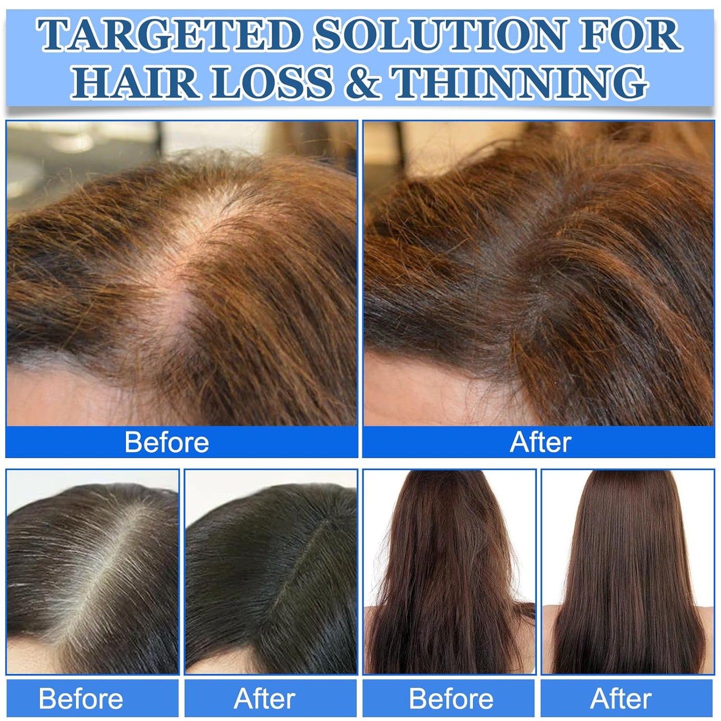 3Pcs Advanced Hair Growth Roll-On Serum, Promotes Growth, Reduces Hair Loss, Nourishes Scalp & Roots with Vitamin E & Natural Oils, For All Hair, Women & Men