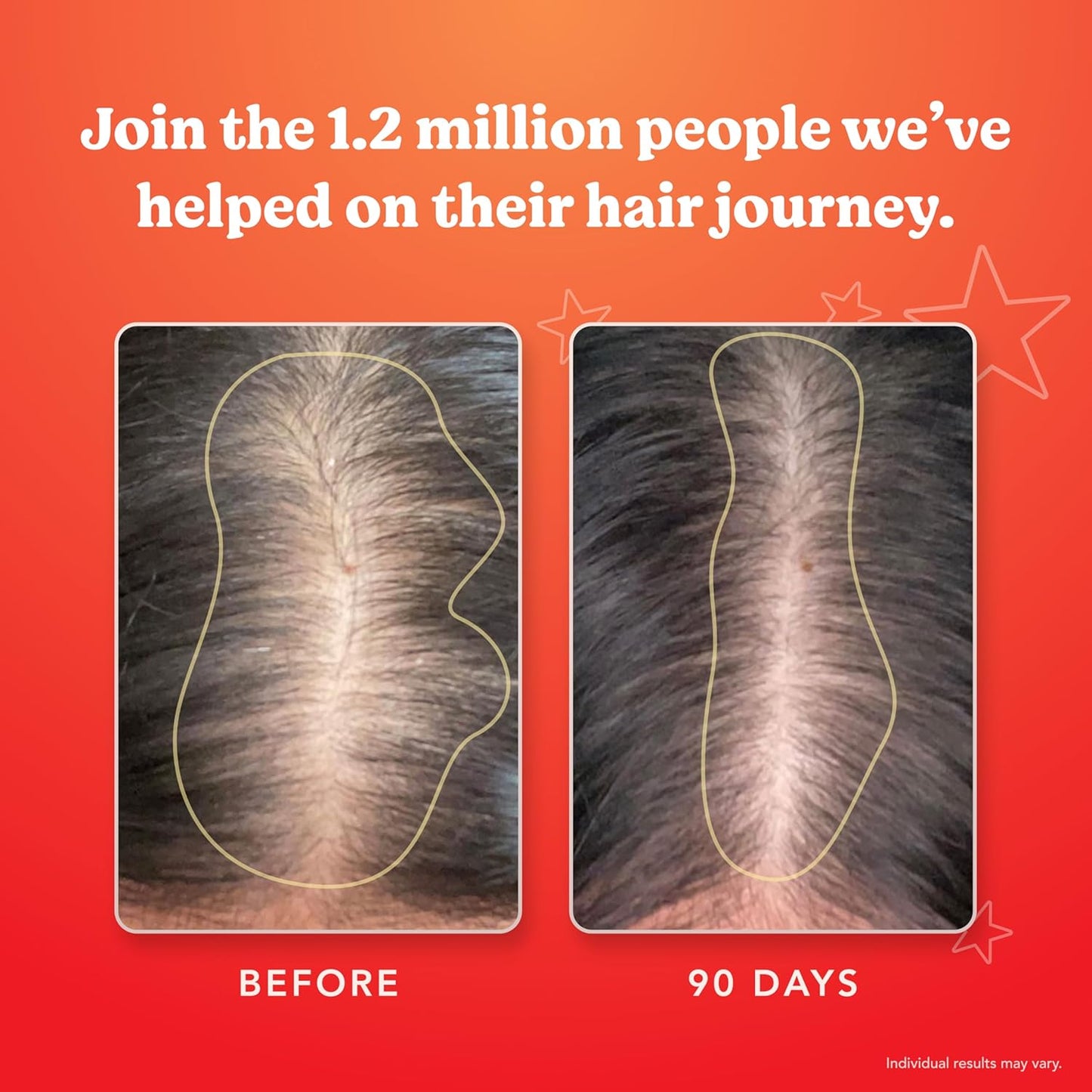 HAIRtamin Advanced Formula Hair Vitamins, Growth Supplement for Women & Men, Supports Stronger, Longer, Visibly Thicker Hair, With 5000 mcg Biotin, Vitamins & Antioxidants, 100% Vegan - 1 Month Supply