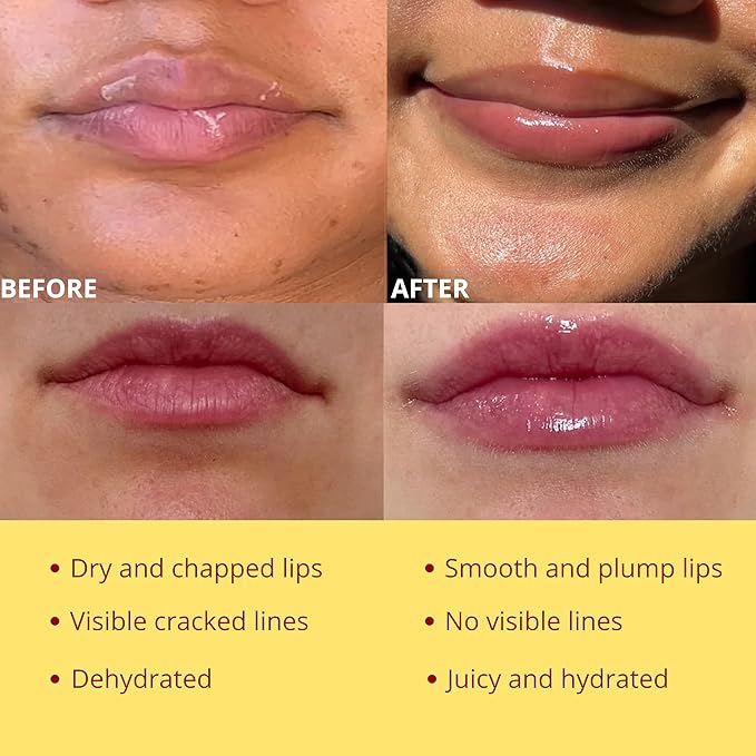 Original My Bee Balm Lip Balm - Propolis Hydrating Balm Honey Pot for Dry, Chapped & Cracked Lips with Propolis, Honey & Vitamin E - Soften, Smooth & Reduce Lip Lines