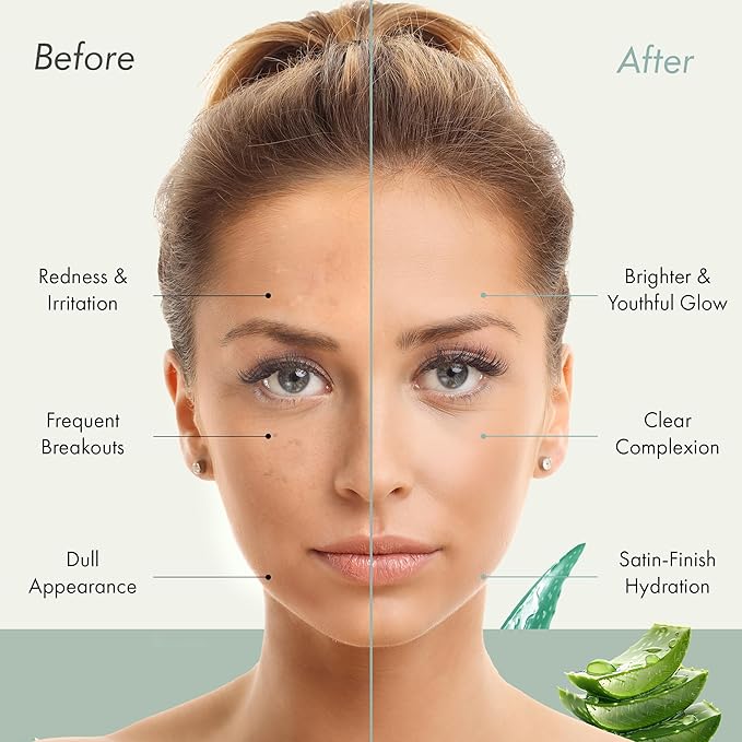 Aloe Attiva 4X POWERLIXIR Serum, Antioxidant-Rich Aloe Vera Serum with Plant-Based Collagen and Hyaluronic Acid,Fragrance-Free Aloe Vera Gel for Face Moisturizer Skin Care for Women 1 Oz Face Serum