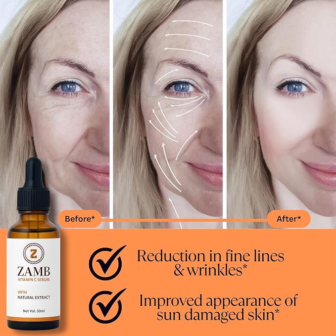 Zamb 15% Vitamin C Face Serum for Glowing Skin – Anti Aging, Hydrating, Brightening, Dark Spot Remover, Even Skin Tone, With Hyaluronic Acid & Natural Extract, For all type of skin – 1 fl oz