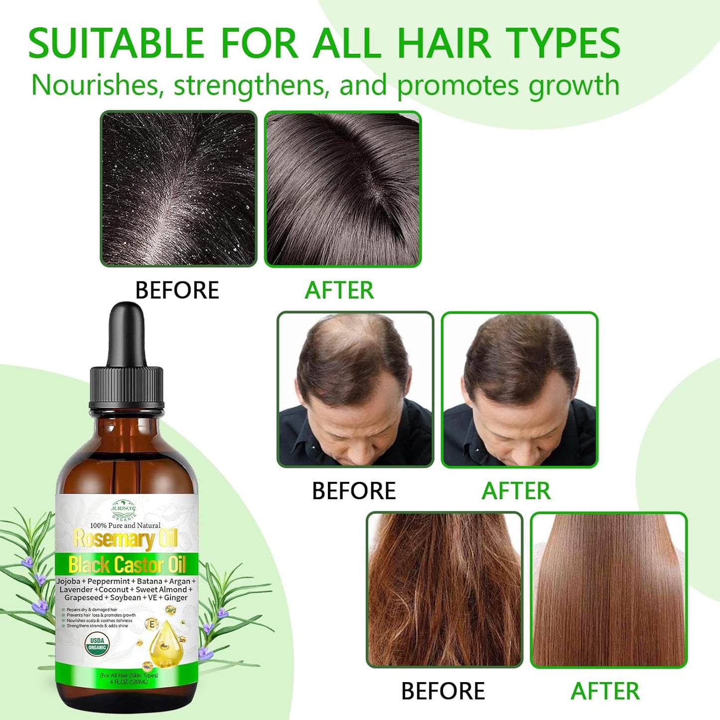 Organic Rosemary Oil for Hair Growth, Rosemary Oils with Castor – USDA Certified Cold Pressed Blend Hair Oil for Thicker, Fuller Hair, Soothe Itchy Scalp & Repair Damaged Hair – 4 fl oz