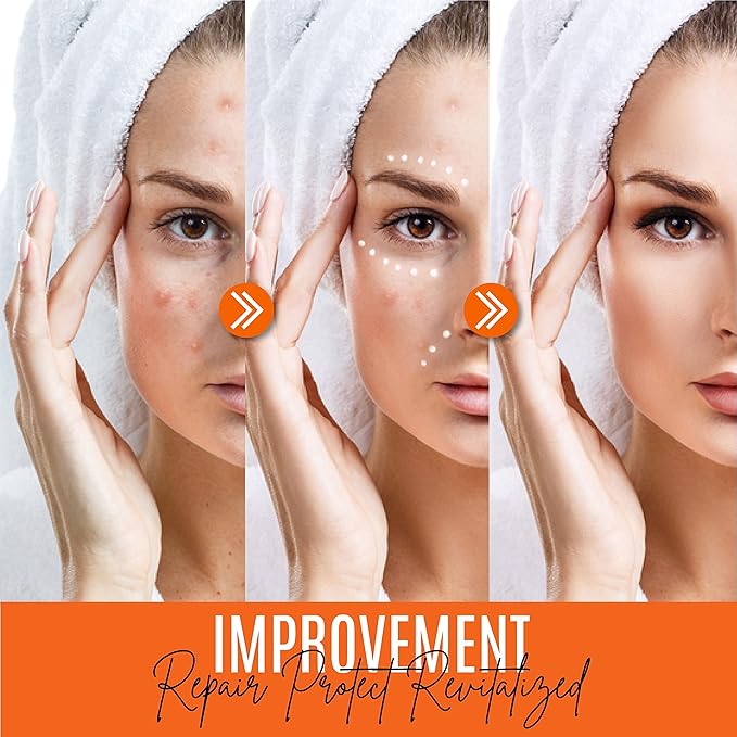 30% Vitamin C Serum for Face, Hyaluronic Acid & Vitamin E - Natural & Organic Anti Wrinkle & Skin Rejuvenator Moisturizer Vitamin C for All Skin - Anti Aging Serum (2 FL OZ)