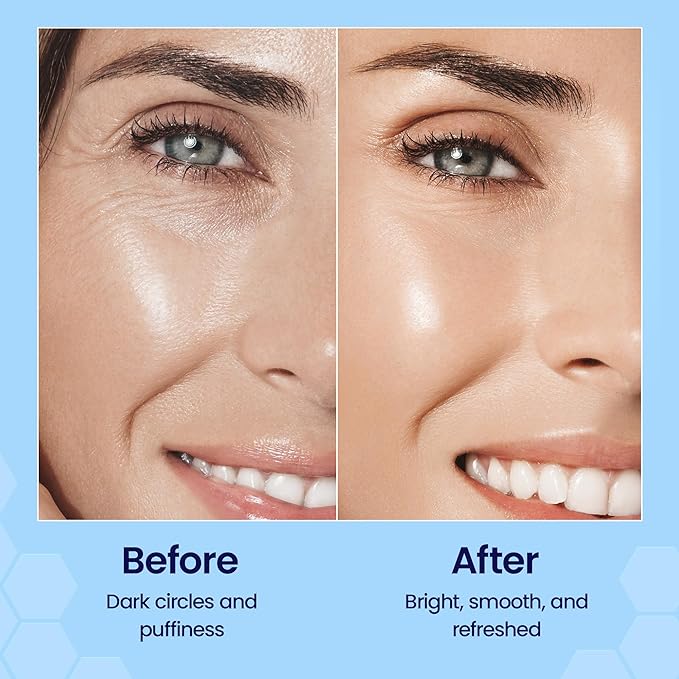 Eye Firm Antioxidant Nano Serum - with Hyaluronic Acid, Manuka Honey and Aloe Vera - Anti Aging and Anti Wrinkle - Spots and Hyperpigmentation Treatment (0.5oz)